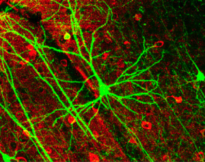 Pyramidal Neuron in Mouse Cortex